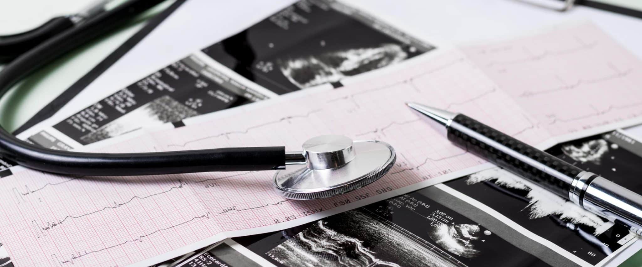 How Predictive Modeling in Healthcare Transforms Preventive Care