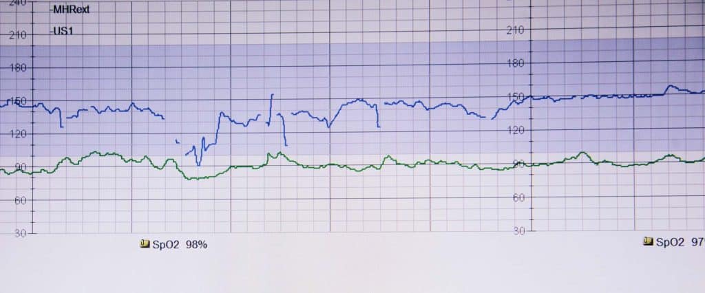 How to Improve Patient Outcomes with Data Mining in Healthcare