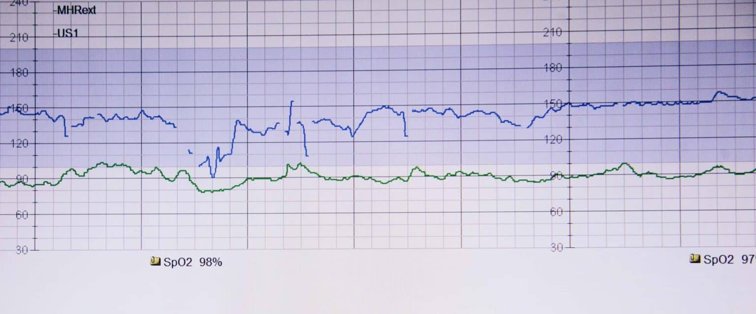 How to Improve Patient Outcomes with Data Mining in Healthcare